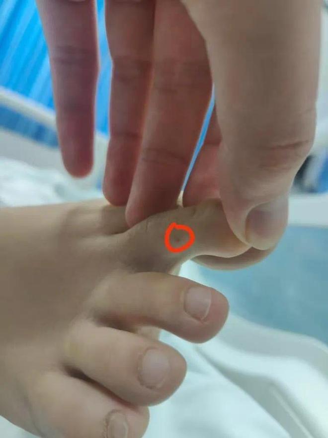 九游体育：三亚女孩被蛇咬风波最近情况！蛇咬或被否定男友却被网友骂害人(图4)